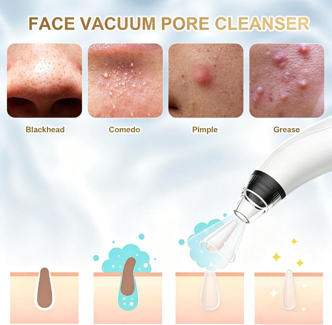 Pore Cleaning Device